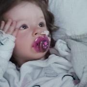 Two-year-old Lara Symes suffered a stroke on Saturday morning