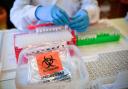 39 new coronavirus cases confirmed in Dorset