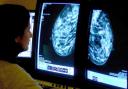 Waiting times for cancer scans could be cut to four weeks if directly ordered by a GP, NHS England says