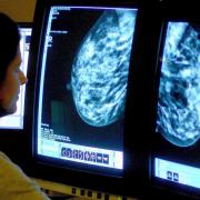 Waiting times for cancer scans could be cut to four weeks if directly ordered by a GP, NHS England says