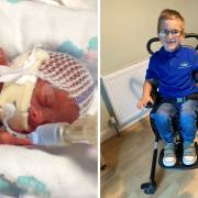 Left: Charlie after he was born premature. Right: Charlie in his wheelchair