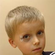 COIN INJURY: Little Ollie Butler had to have stitches near his eye